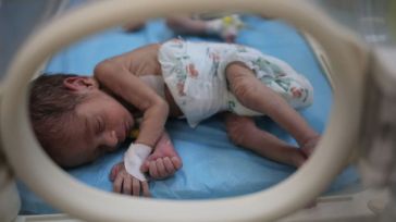 Recién nacidos a punto de morir: El uso del hambre como estrategia puede ser un crimen de guerra