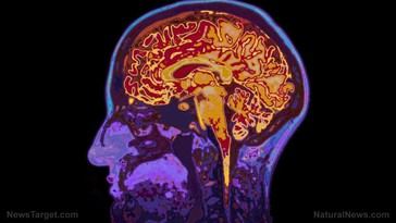 La mayoría de los estadounidenses teme perder la memoria, pero pocos saben cómo cuidar su cerebro