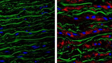 Ciencia española: Al descubierto una de las causas de los aneurismas de aorta en el síndrome de Marfan