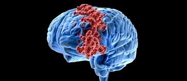 Un padre supera un tumor cerebral terminal gracias a un protocolo alternativo