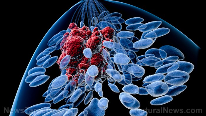 Estudio revela que mujeres obesas que retrasan la maternidad hasta después de los 30 años triplican su riesgo de cáncer de mama