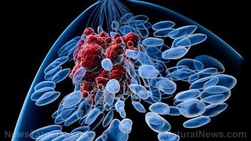 Estudio revela que mujeres obesas que retrasan la maternidad hasta después de los 30 años triplican su riesgo de cáncer de mama