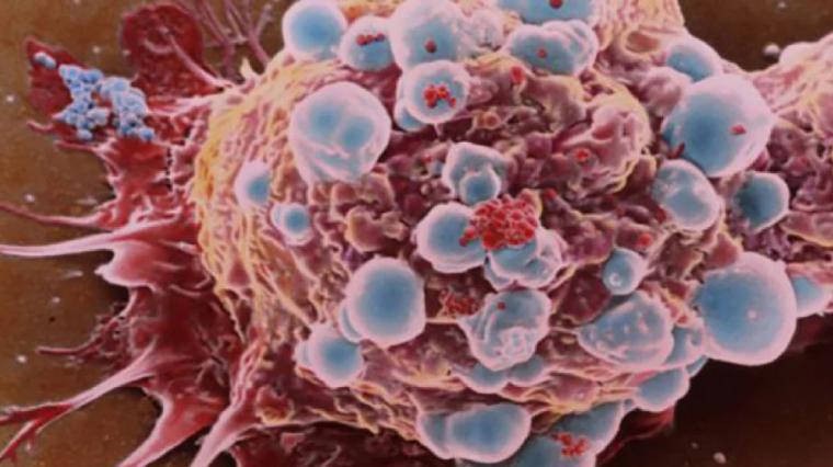 Un 'interruptor' hará que las células cancerosas se autodestruyan