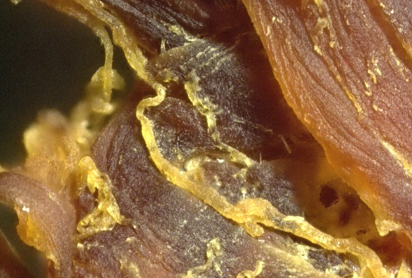 Alarma por micro-coágulos en cuerpos de vacunados que podrían afectar transfusiones sanguíneas