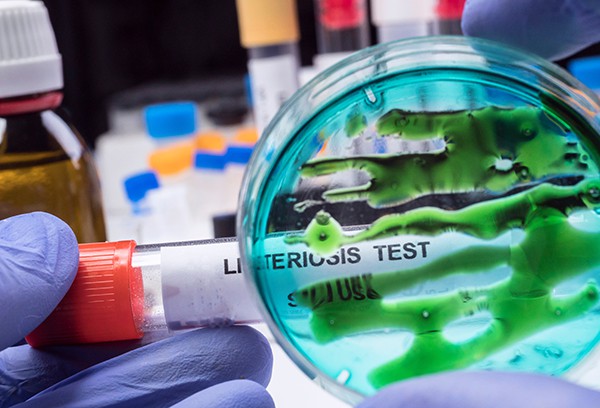 Estudio danés revela que desinfectantes comunes pueden ser ineficaces contra superbacterias de Listeria