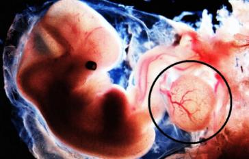 Cultivan riñones embrionarios humanizados dentro de cerdos durante 28 días