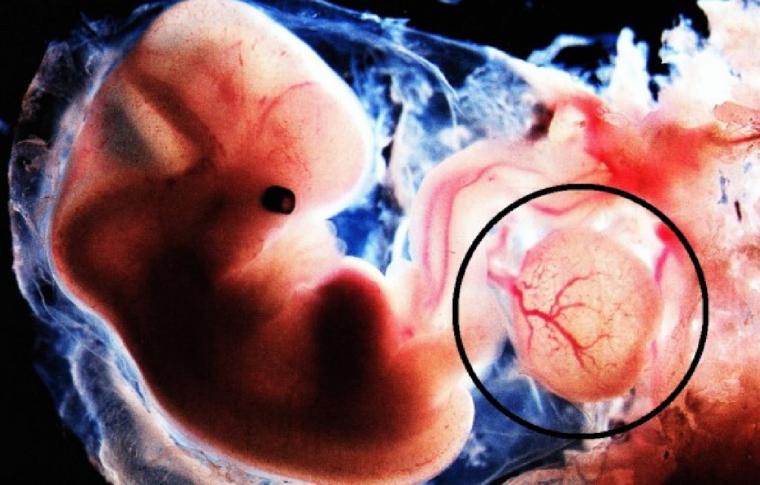 Cultivan riñones embrionarios humanizados dentro de cerdos durante 28 días