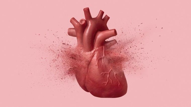 Los betabloqueantes tras infartos podrían ser peligrosos para las mujeres