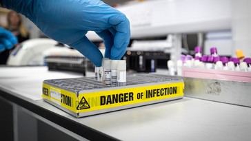 FBI desmantela laboratorio biológico ilegal en Las Vegas con muestras de Ebola y VIH