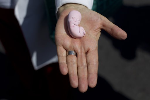 Estudio revela que el 10% de usuarias del aborto con pastillas enfrenta complicaciones severas, 22 veces más que lo informado por la FDA