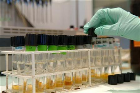 Urine terapia: un enfoque controvertido para combatir la adicción
