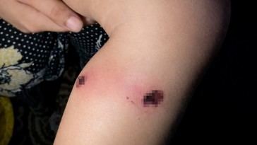 Ejército israelí niega torturas a niño palestino de 18 meses tras acusaciones