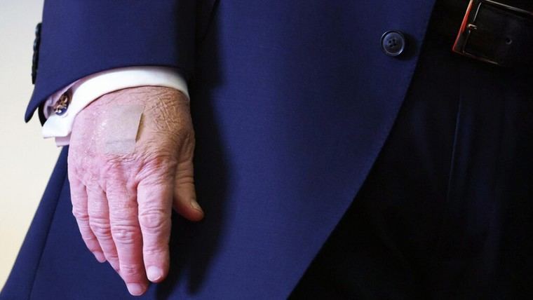 La Casa Blanca aclara los vendajes en la mano de Trump tras especulaciones sobre su salud