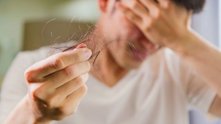 Los países latinoamericanos con mayor calvicie masculina