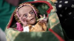 La desnutrición severa pone en riesgo a unos gemelos recién nacidos en Yemen