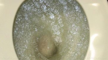 Escucha a tu vejiga: consejos de expertos para cuidar tu salud urinaria