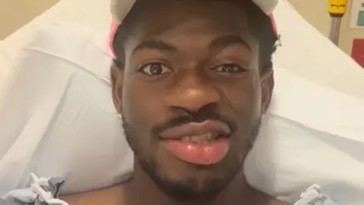 Lil Nas X anuncia diagnóstico de parálisis facial tras vacunación con mRNA