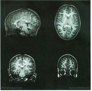 Aumenta la preocupación por casos raros de cáncer cerebral infantil en Kentucky