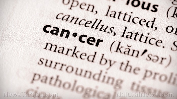 Aumento alarmante de cáncer de apéndice en jóvenes genera preocupación entre expertos
