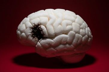 Alto consumo de azúcar incrementa riesgo de demencia en un 43% según estudio