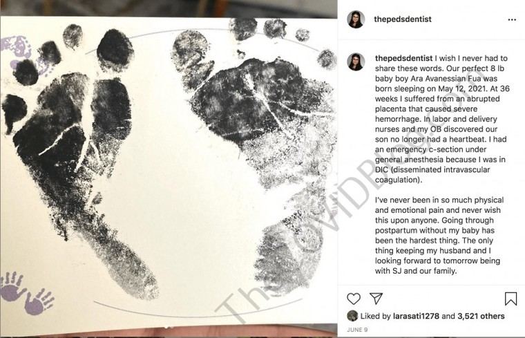 La tasa de mortinatos en EE. UU. disminuye, pero persisten desigualdades raciales y brechas sistémicas