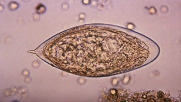Infección parasitaria podría elevar el riesgo de cáncer cervical en mujeres