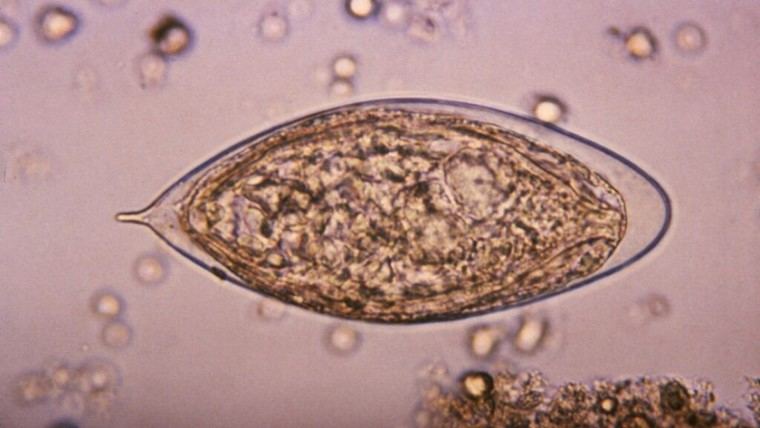 Infección parasitaria podría elevar el riesgo de cáncer cervical en mujeres
